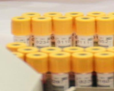Bloodborne Pathogens in First Response Environments